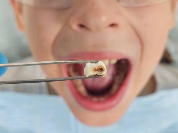 Best Emergency Dental Care for Broken or Chipped Teeth in Robstown, TX